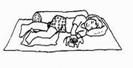 小儿脑瘫的家庭护理 537.png 小儿脑瘫的家庭护理 537.png